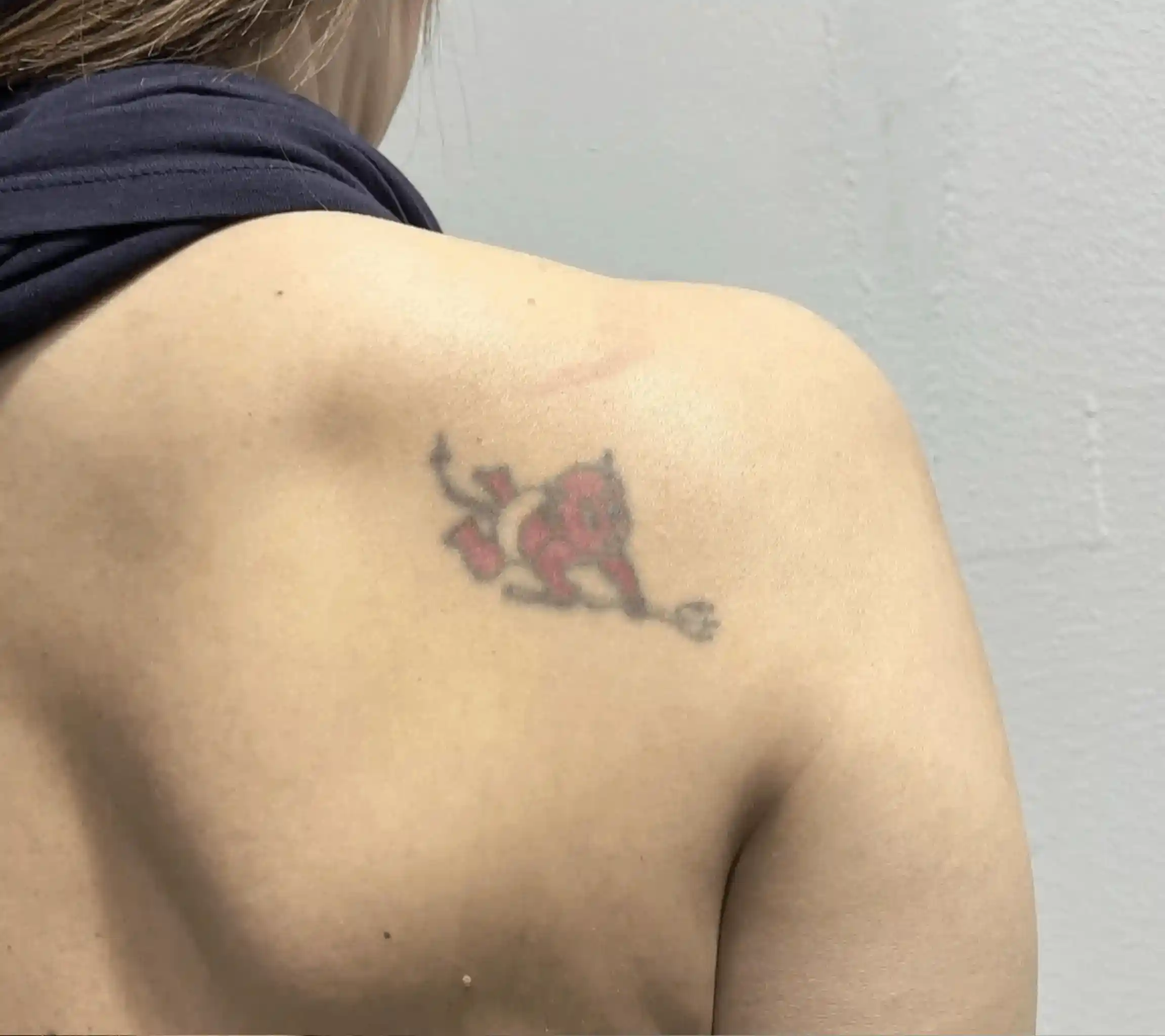 Cover Up 1 Imagen Antes